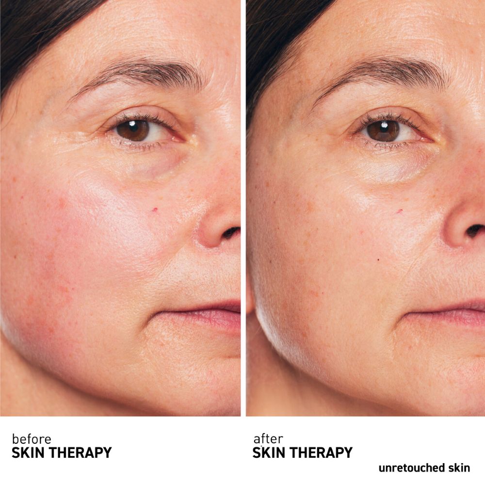 Skin Therapy - Siero notte in olio