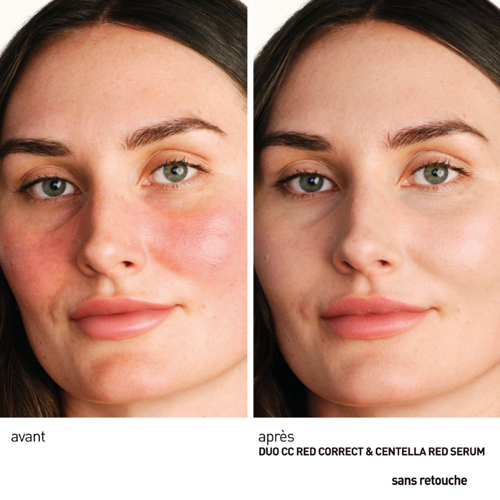 Centella Red Serum 30ml
